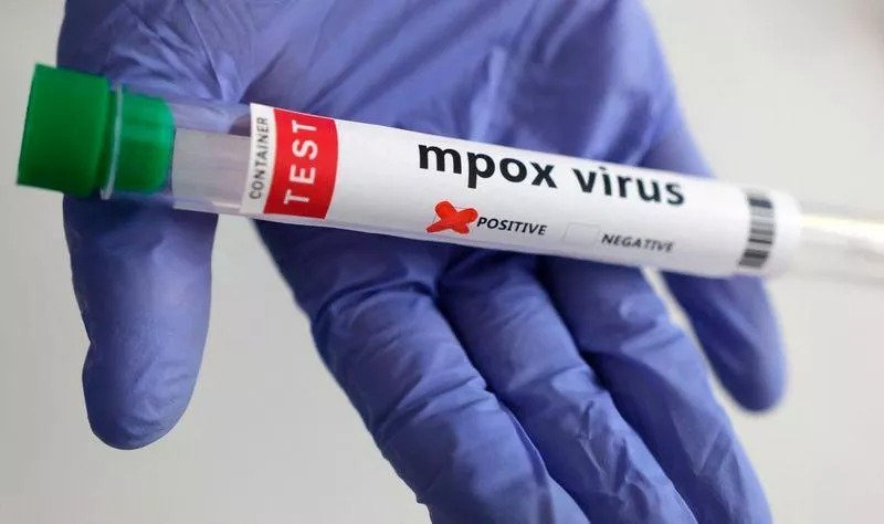 Health Services On Alert For Mpox Cases Even Though Risk Is Low