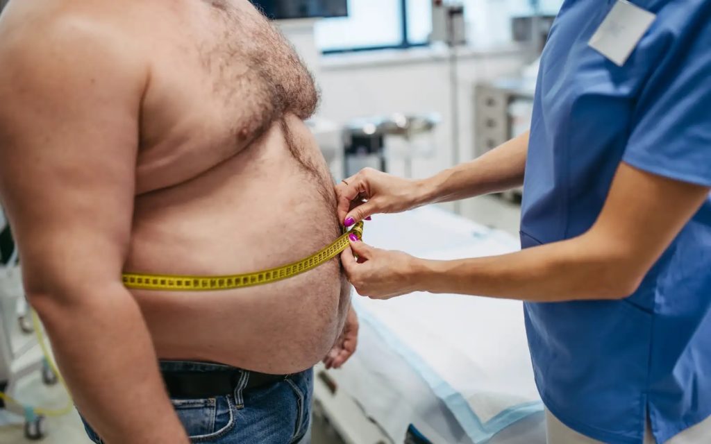 Experts Call For New Approach To Obesity Diagnosis