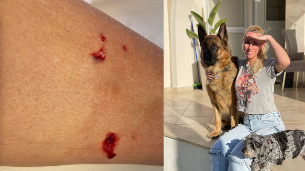 Charlotte Paphos Dog Attack Picture