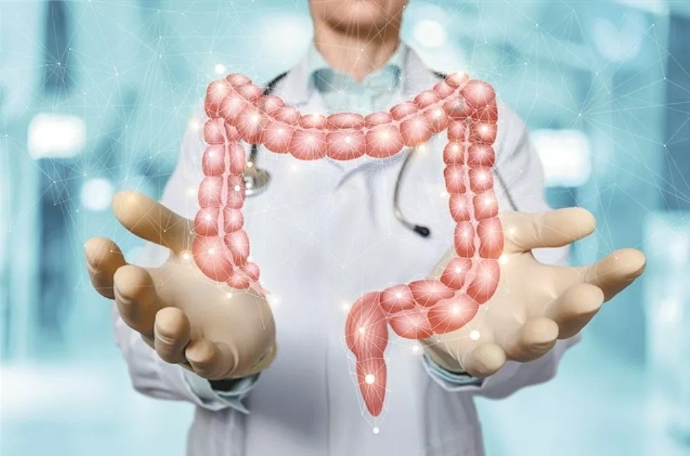 Bowel Cancer Rising Among Young People Worldwide, Study Finds
